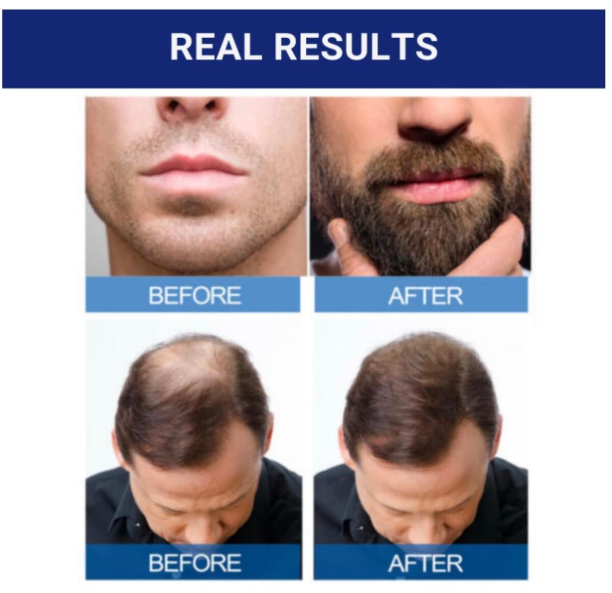 Kirkland Signature 5% Minoxidil Liquid – Hair Regrowth Treatment (Single Pack) - Image 5
