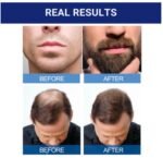 Kirkland Signature 5% Minoxidil Liquid – Hair Regrowth Treatment (Single Pack) - Image 5