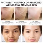 VIBRANT GLAMOUR FDA Retinol Cream + Serum Hyaluronic - Image 6
