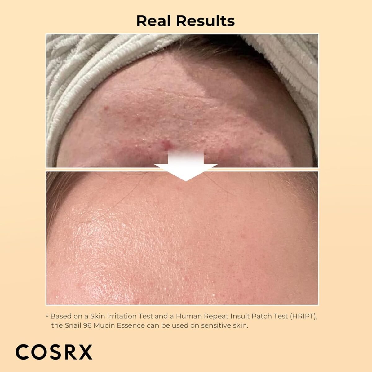 COSRX Advanced Snail Set – Essence + Cream Combo - Image 4