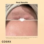 COSRX Advanced Snail Set – Essence + Cream Combo - Image 4