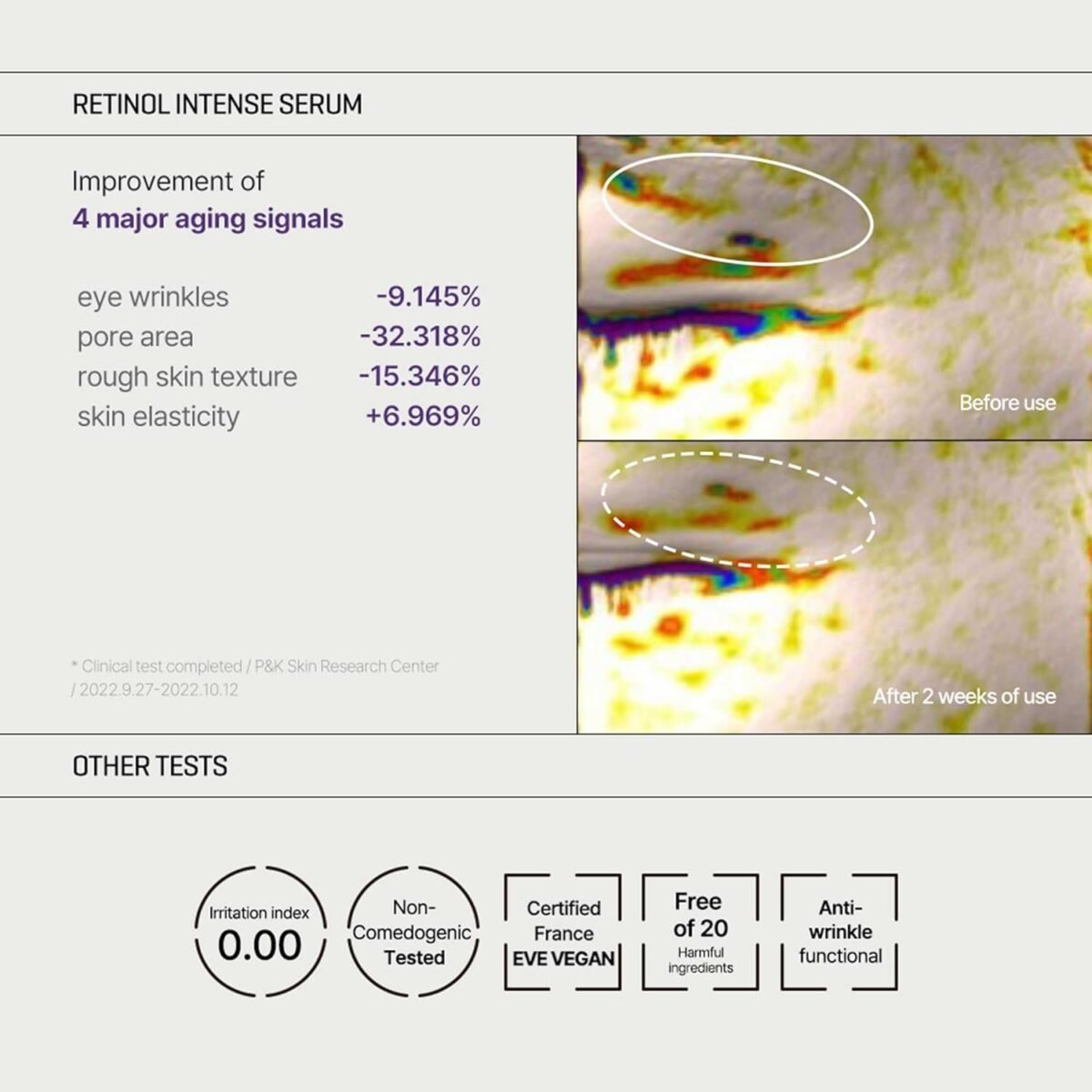 SOME BY MI – Retinol Intense Trial Kit - Image 7