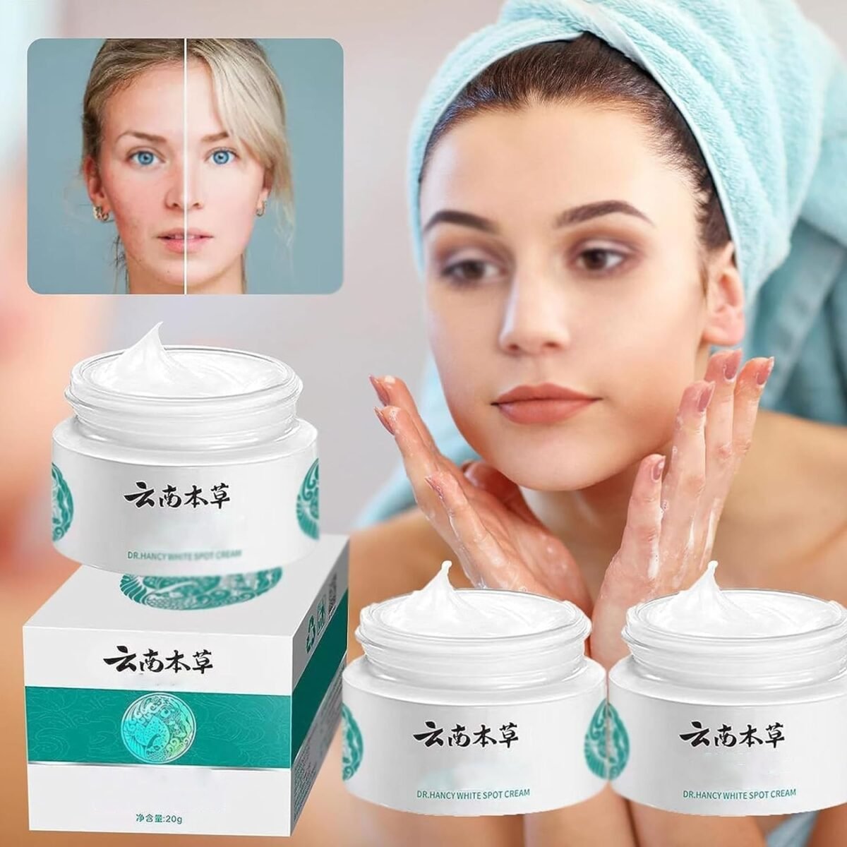 Dr. Hancy White Spot Melasma Cream - Image 1