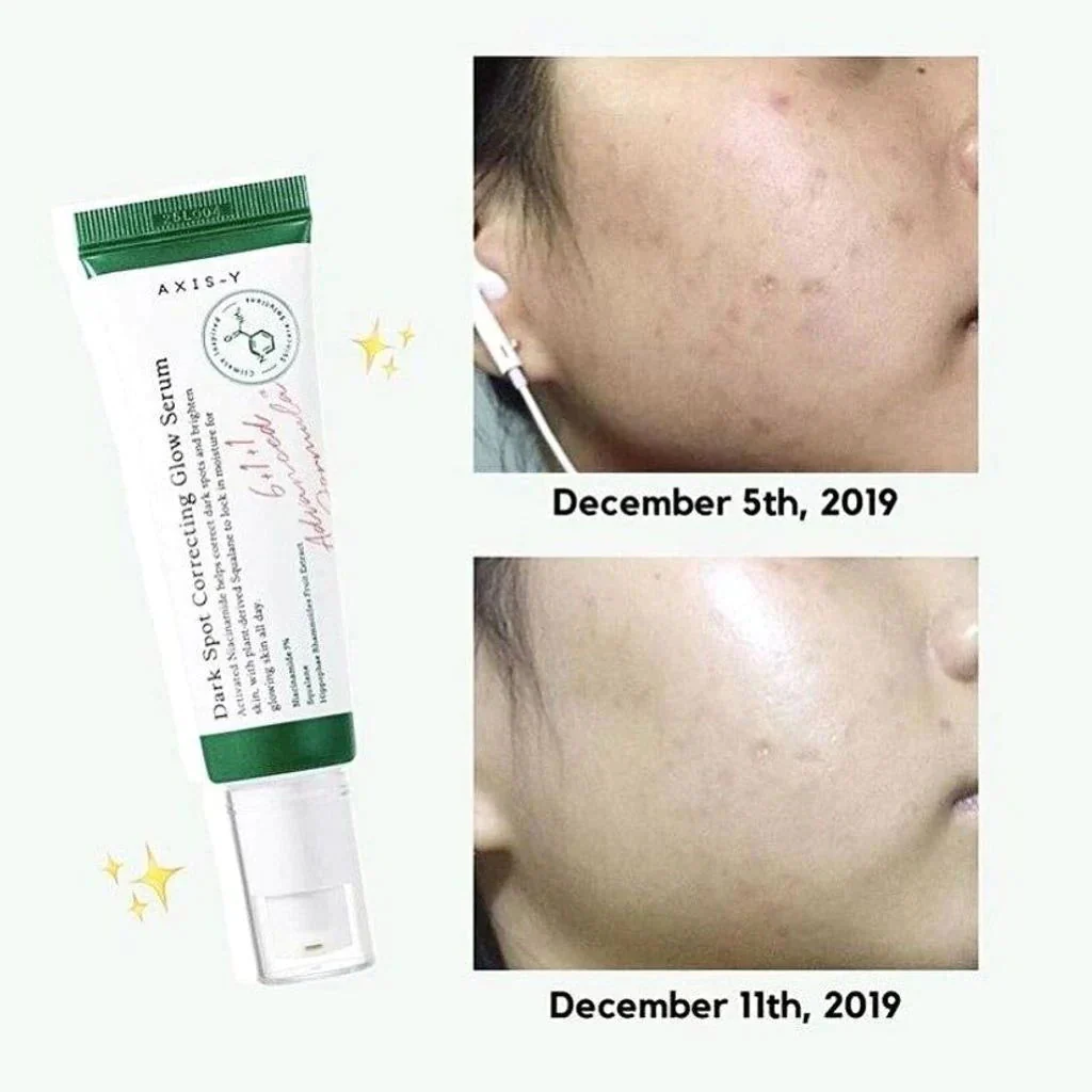 AXIS-Y Dark Spot Correcting Glow Serum - Image 3