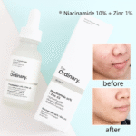NIACINAMIDE ORDINARY (30ml) - Image 2