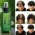 Neo Hair Lotion (120ml) - Image 3