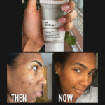 Ordinary Vitamin C Suspension 30% in Slitcone - Image 3