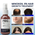 FEG Plus Hair Growth Spray (30ml) - Image 4